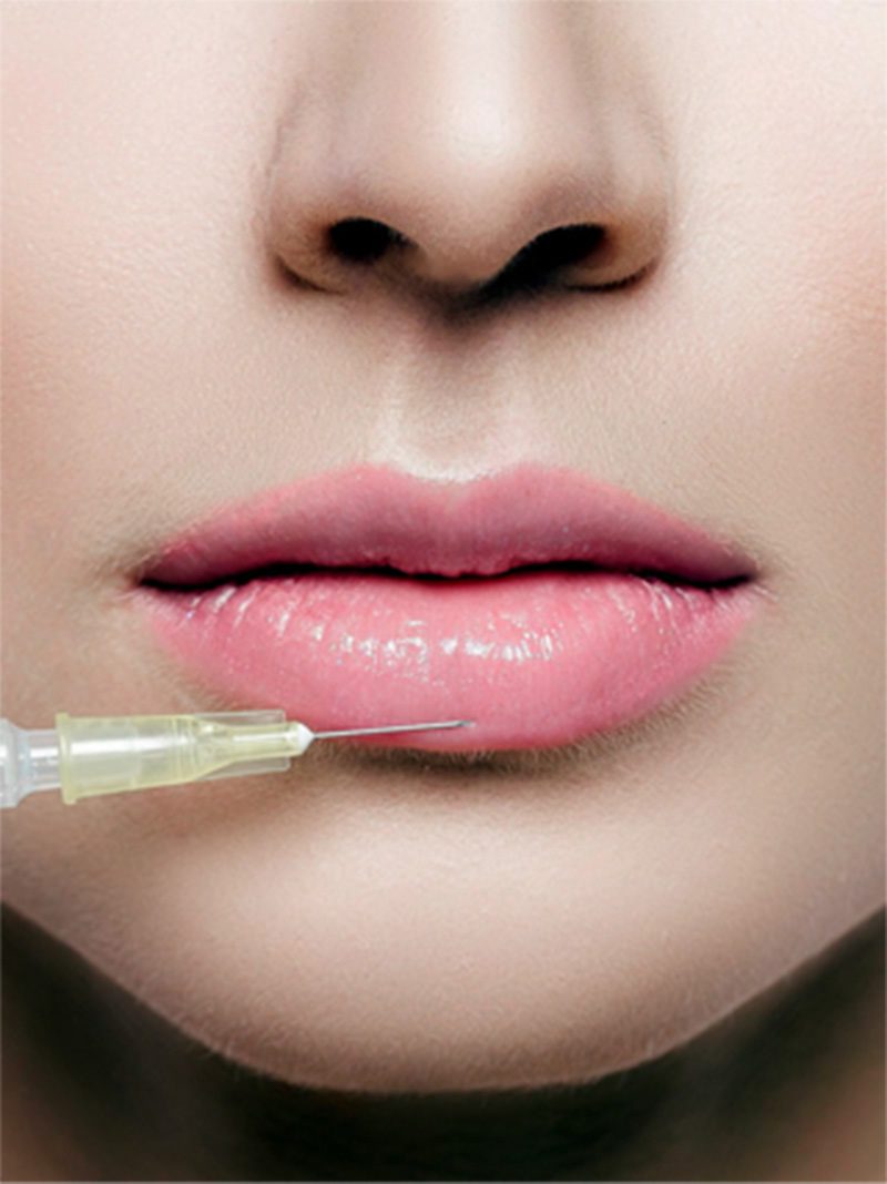 dermal-fillers-featured Lips having injection